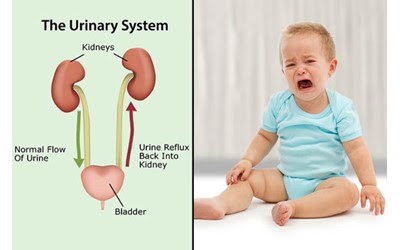 علت عفونت ادراری در کودکان پسر