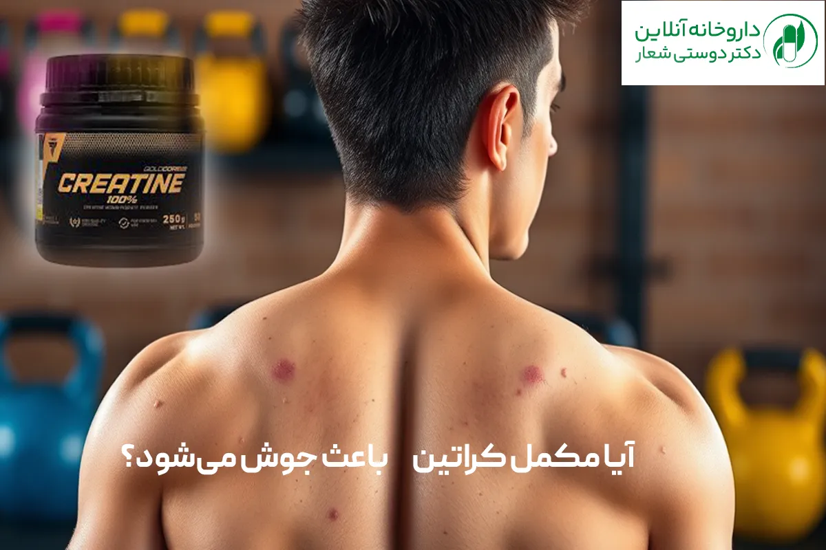 آیا مکمل کراتین باعث جوش می‌‌شود؟