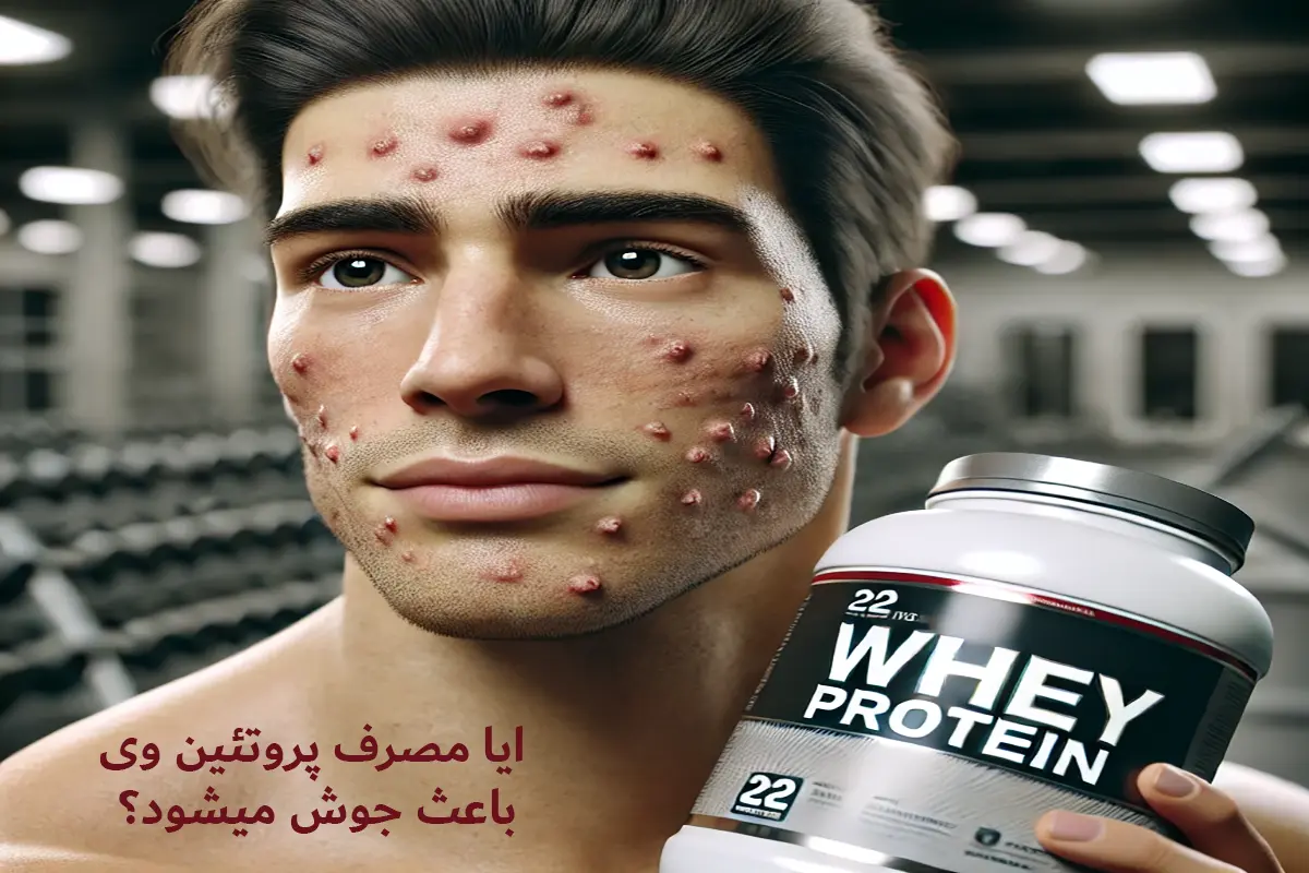 ایا پروتئین وی باعث جوش میشود
