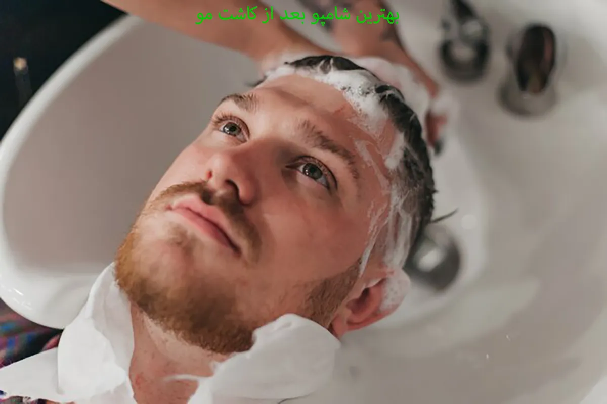 بهترین شامپو بعد از کاشت مو